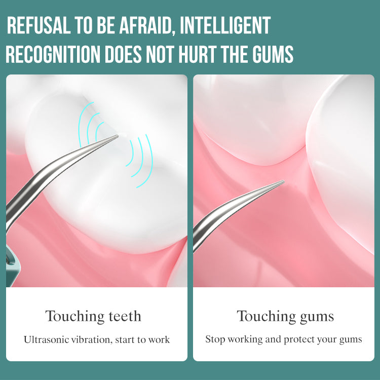 The tool of Plaque Remover for Teeth, with LED light