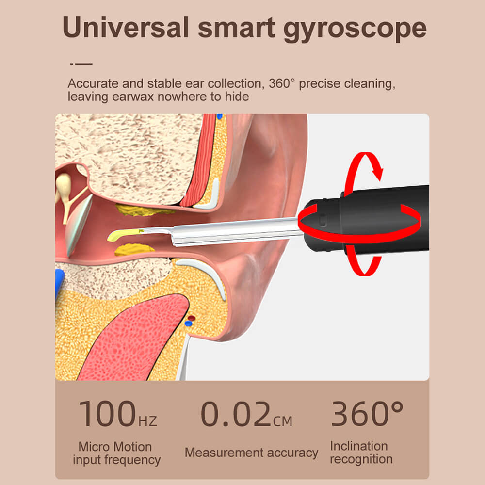 Noyafa Ear Wax Removal Kit with Ear Camera and 6 LED Lights, Ear Pick with 6 Reusable Replacement Soft Ear Scoops Y10 Pro